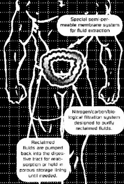 File:Ileocecal Siphon.jpeg