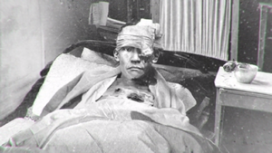 Saburo's injuries .png