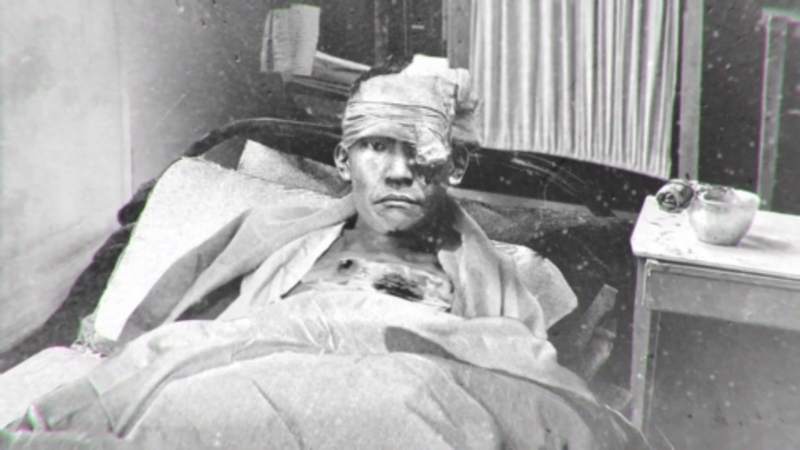 File:Saburo's injuries .png